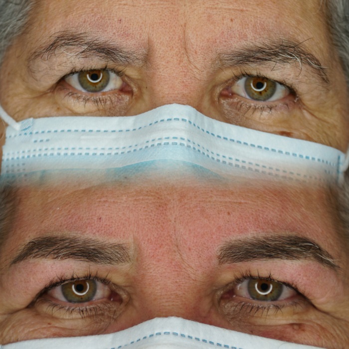 Microblading Oviedo Valoraci N Personalizada microblading oviedo valoración personalizada