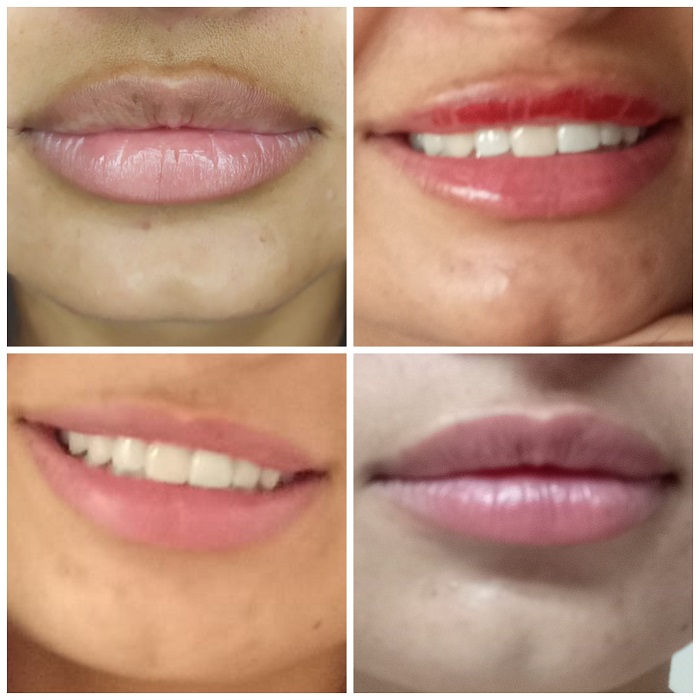 Micropigmentacion Labios Antes Y Despues Asturias micropigmentacion labios antes y despues aviles