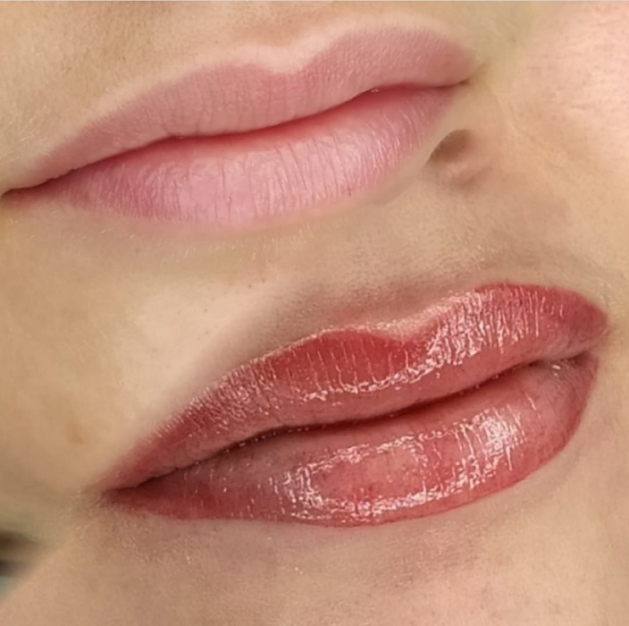 Coloracion De Labios Asturias Resultado Natural coloracion de labios aviles resultado natural
