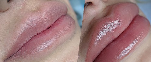 Tratamiento De Micropigmentacion De Labios Asturias tratamiento de micropigmentacion de labios aviles